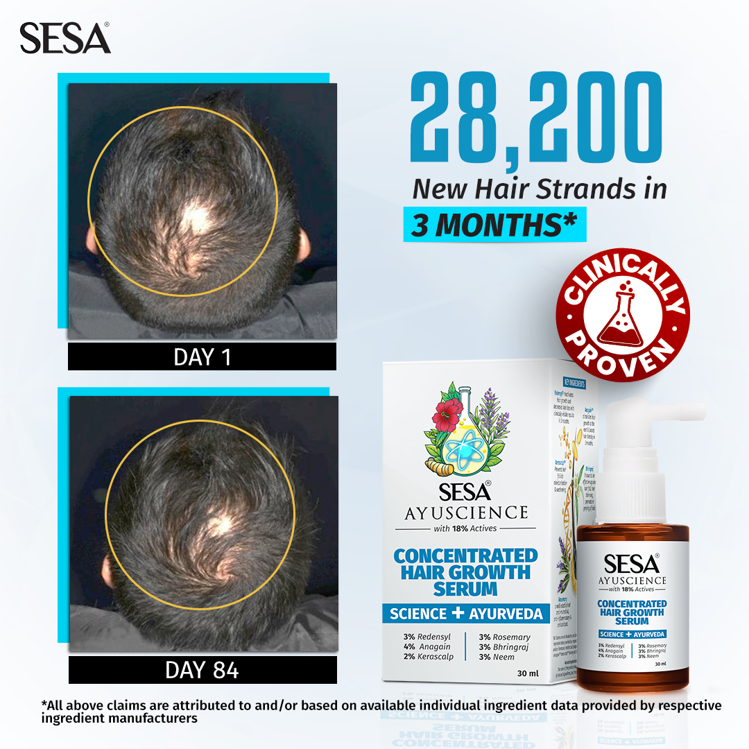 Sérum Capillaire Sesa Ayuscience 30 Ml - 3% Redensyl, 4% Anagain - Naturel, Sans Parabène