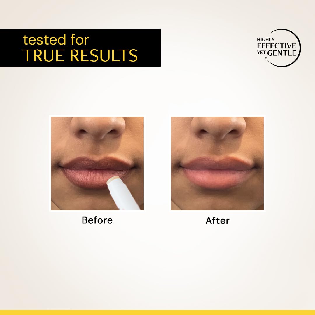 deconstruct vitamin c lip balm RESTOCKED Brightening with SPF 30 | For Dark, Pigmented, Dry, Flaky Lips | Brightens Pigmented Lips | for Dark Lips The 1% Vitamin C helps repair lip discolouration "Pigmented Lips? We dont know