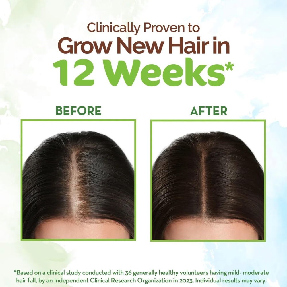 Mamaearth Rosemary Hair Growth Oil 150 ml - Image 3
